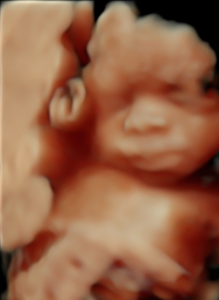 Upload and click Submit then Add to Cart