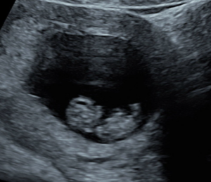 Upload and click Submit then Add to Cart